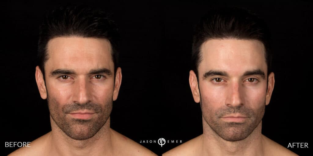 Patient before and after