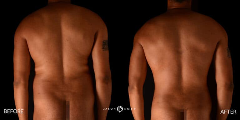 Back Male Gallery 02