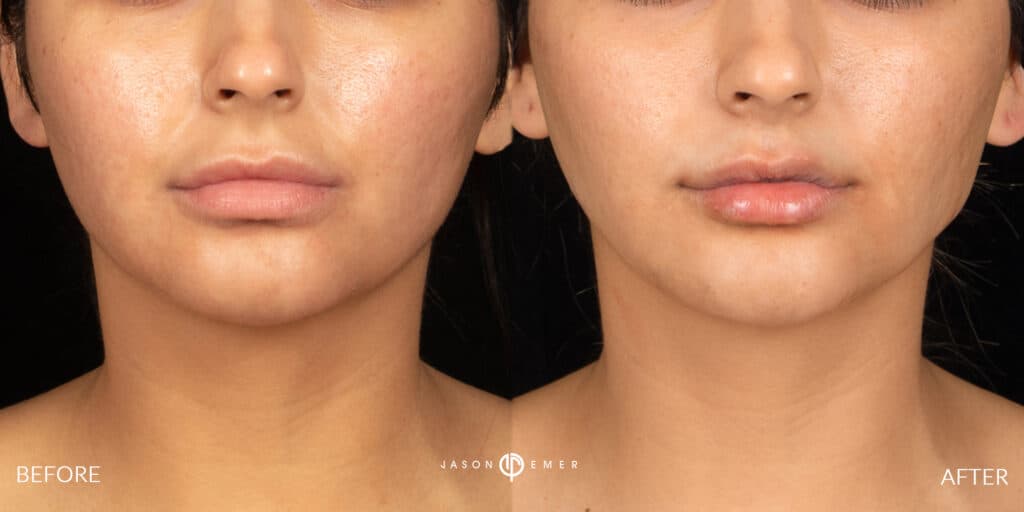 Patient before and after