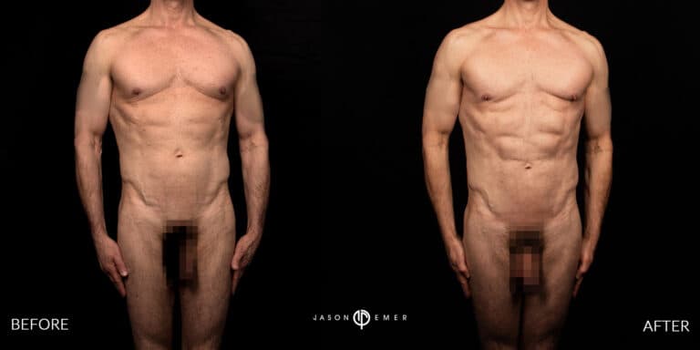 Full Body Male Gallery 02