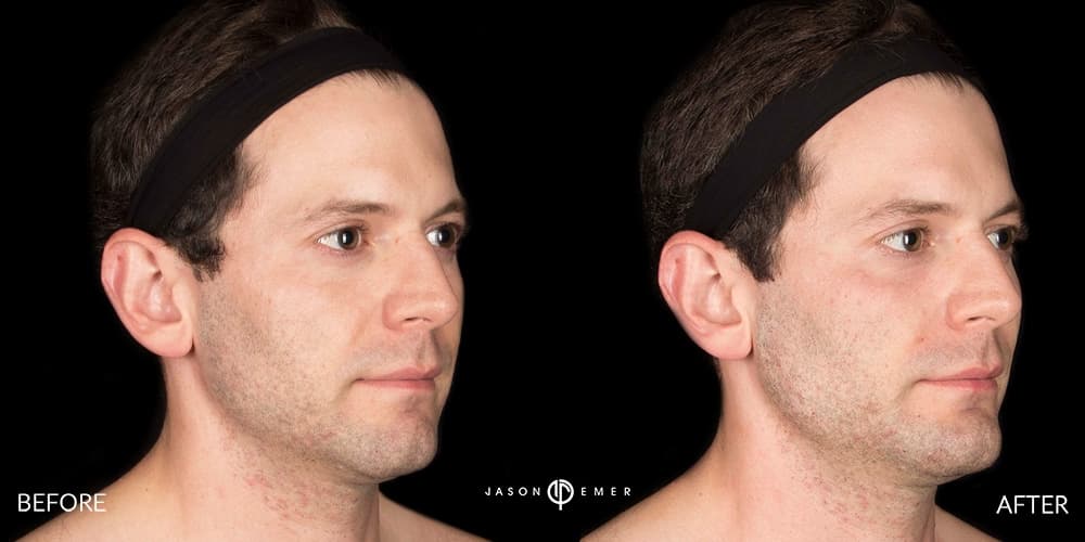 Patient before and after