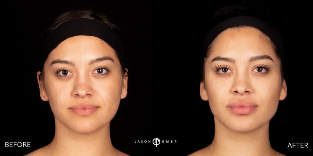 Patient before and after