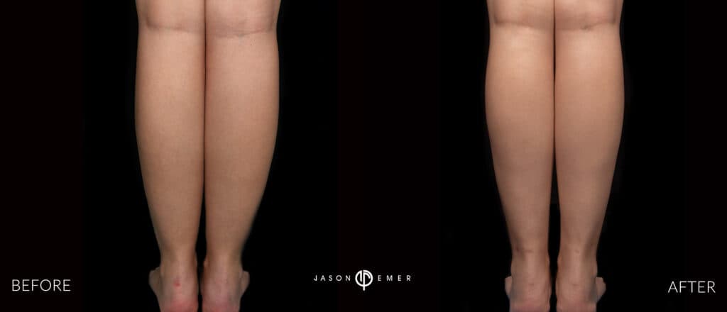 Calves Female Gallery