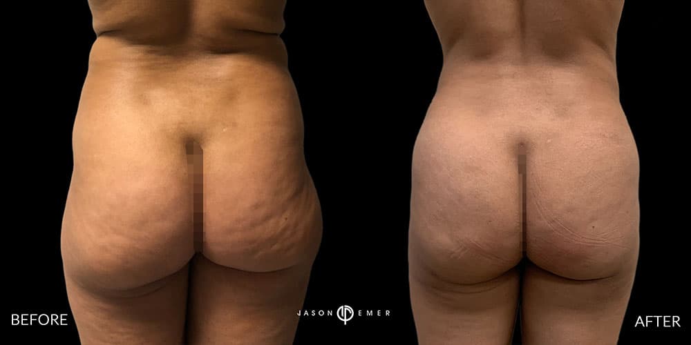 Patient before and after