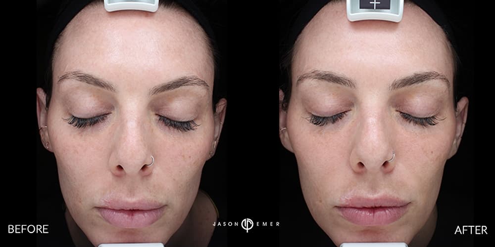 Patient before and after