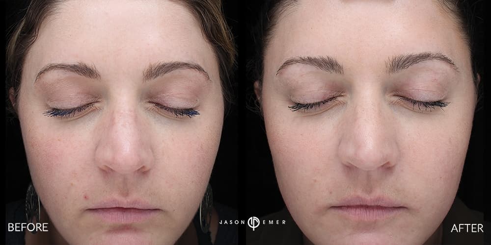 Patient before and after