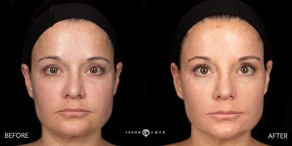 Patient before and after