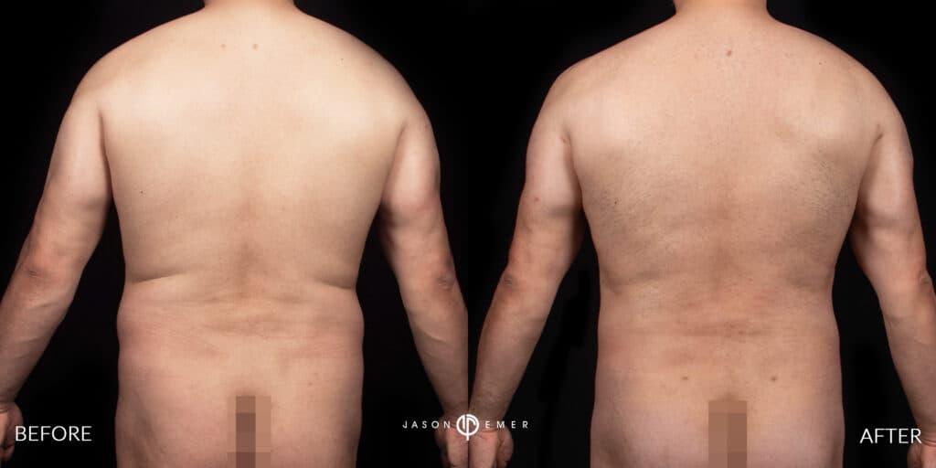 Patient before and after