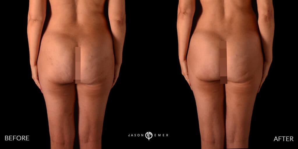 Patient before and after