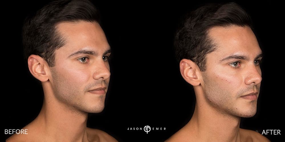 Patient before and after