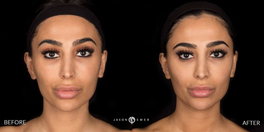 Patient before and after