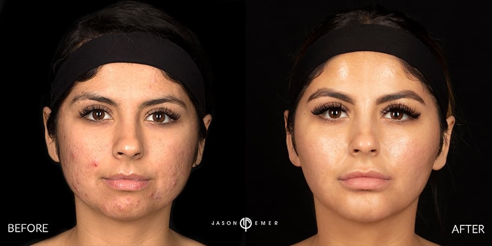 Patient before and after