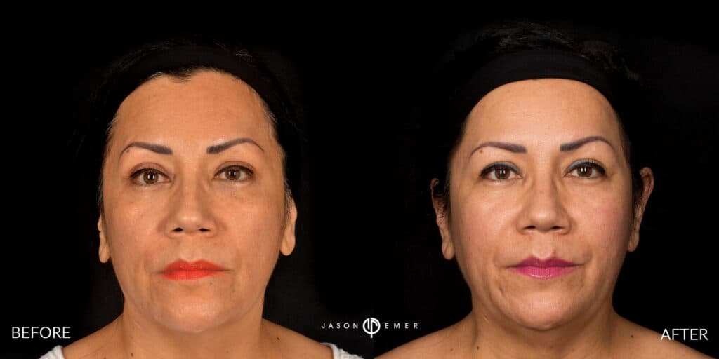 Patient before and after
