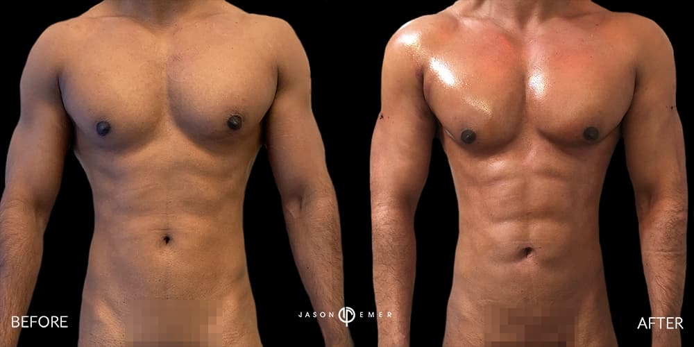 Patient before and after