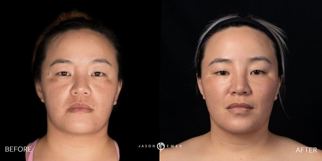 Patient before and after