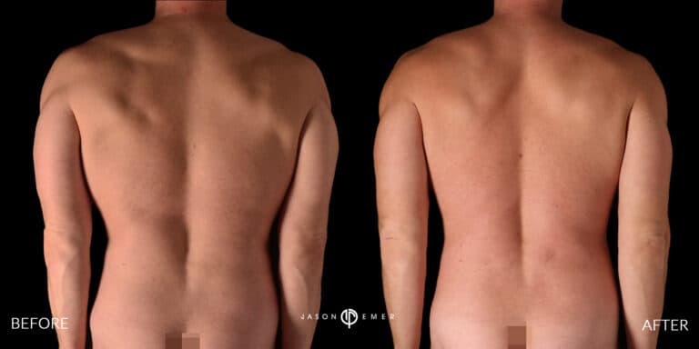 Back Male Gallery 04