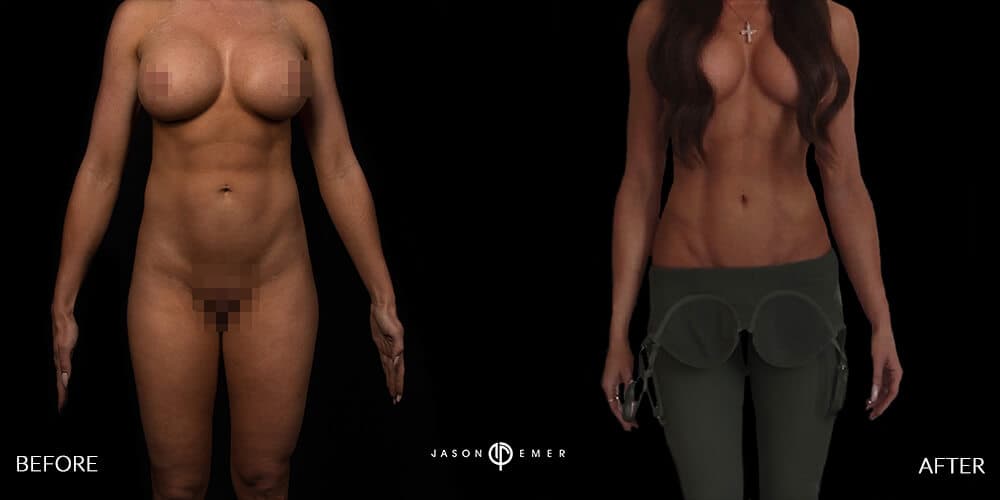 Full Body Female Gallery