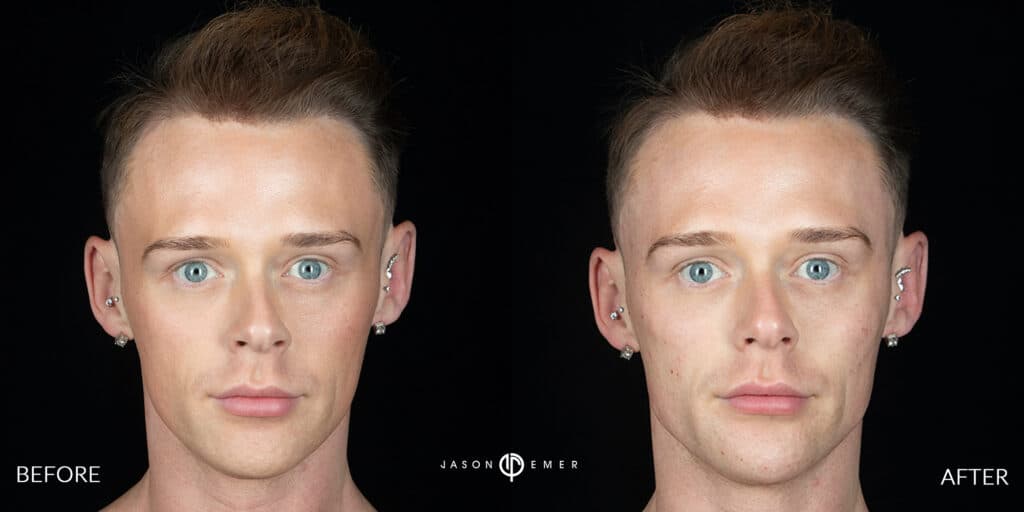 Patient before and after