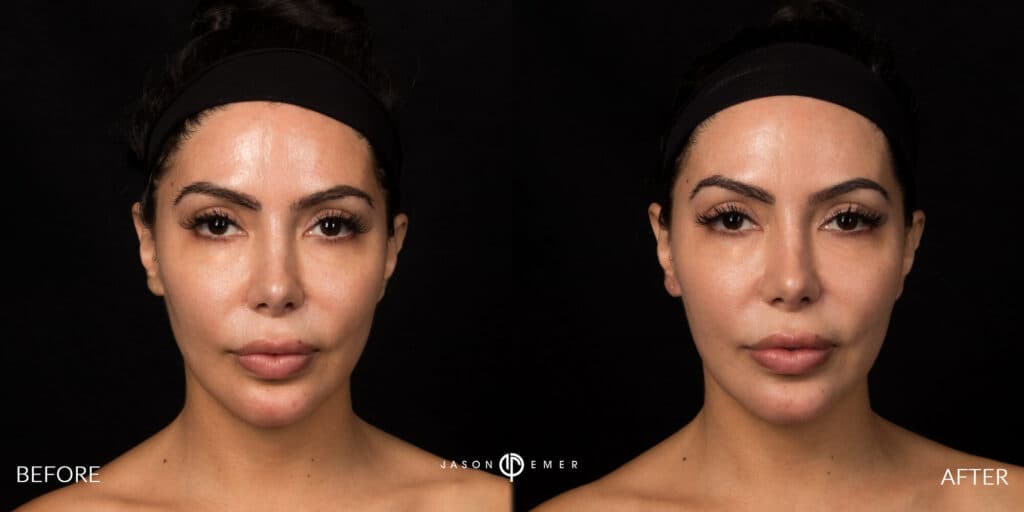 Patient before and after