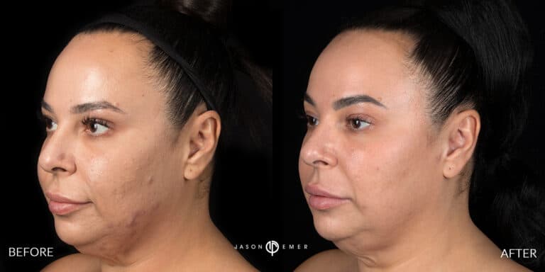 MELASMA GALLERY 01