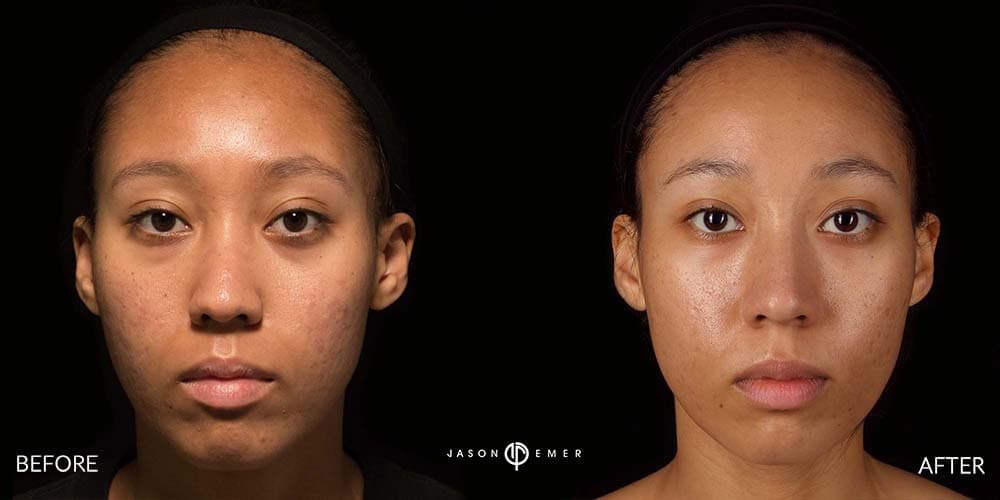 Patient before and after