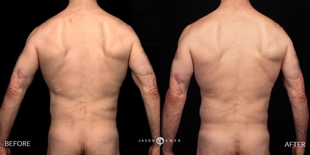 Patient before and after