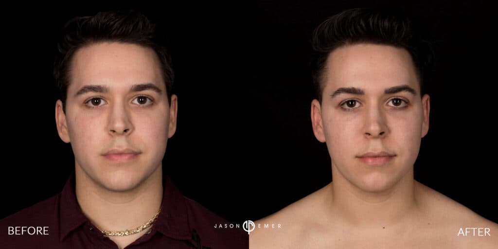 Patient before and after