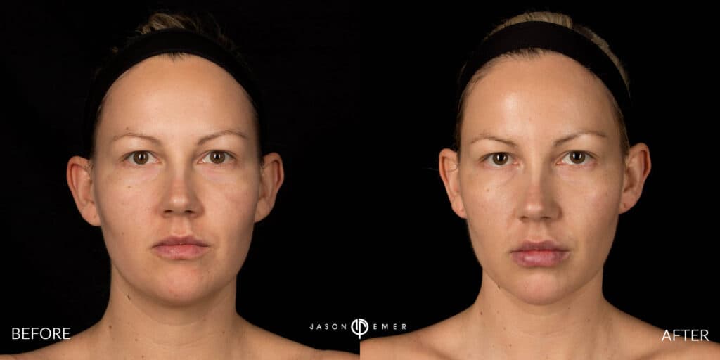 Patient before and after