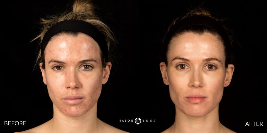 Patient before and after
