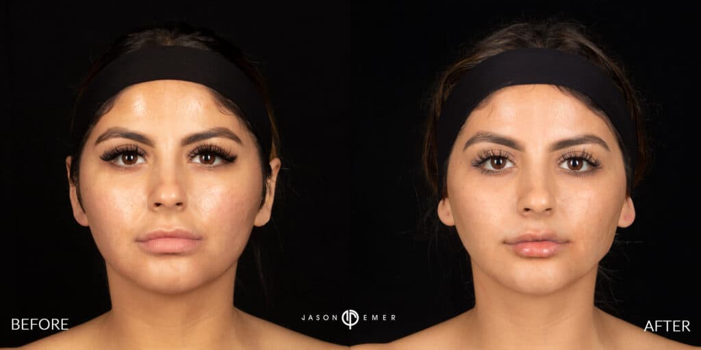 Patient before and after
