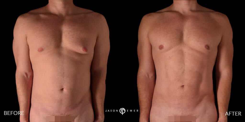 Patient before and after