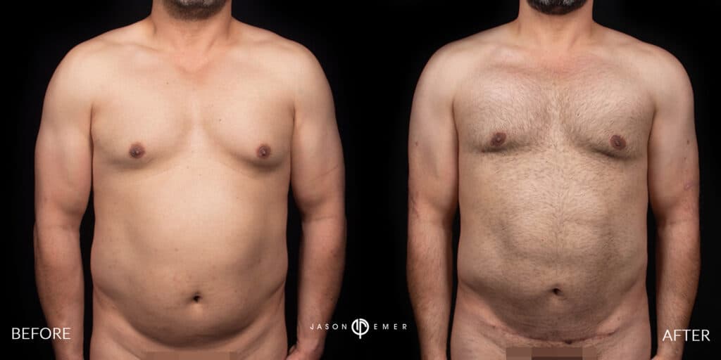Patient before and after
