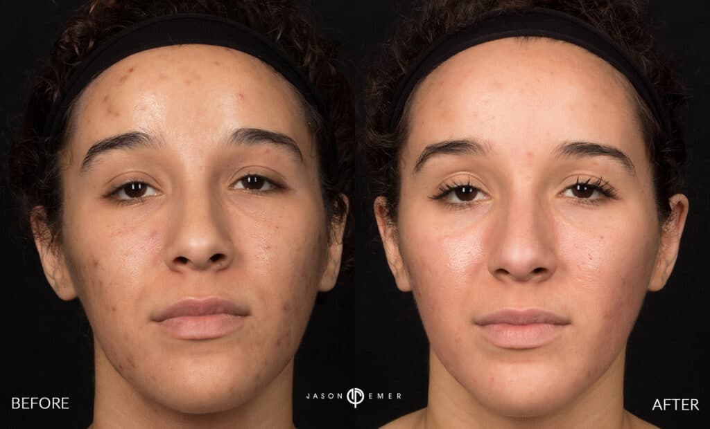Patient before and after