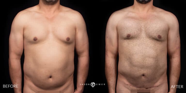 Abs Male Gallery 03