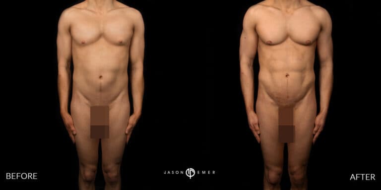 Full Body Male Gallery 01