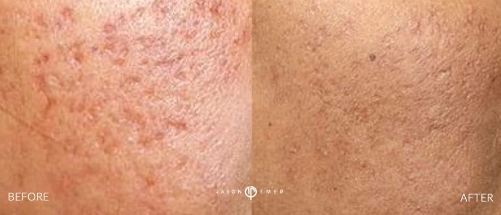 Patient before and after