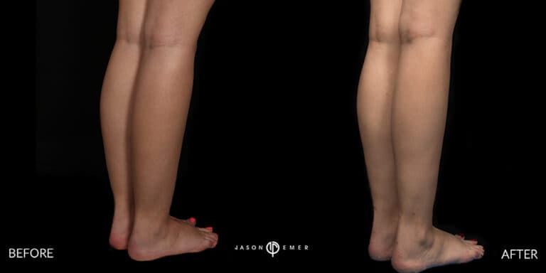 CALVES FEMALE GALLERY 02