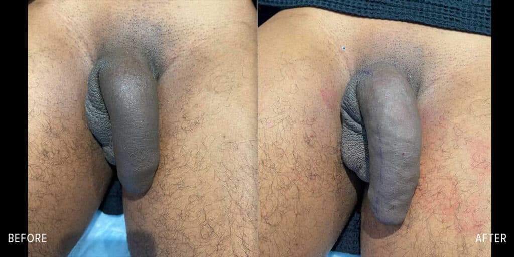 Patient before and after