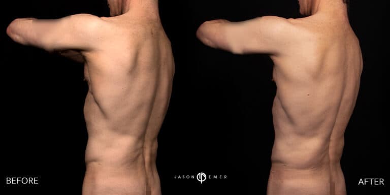 Back Male Gallery 05