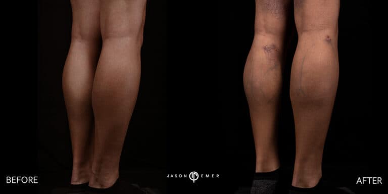 Calves Male gallery 01