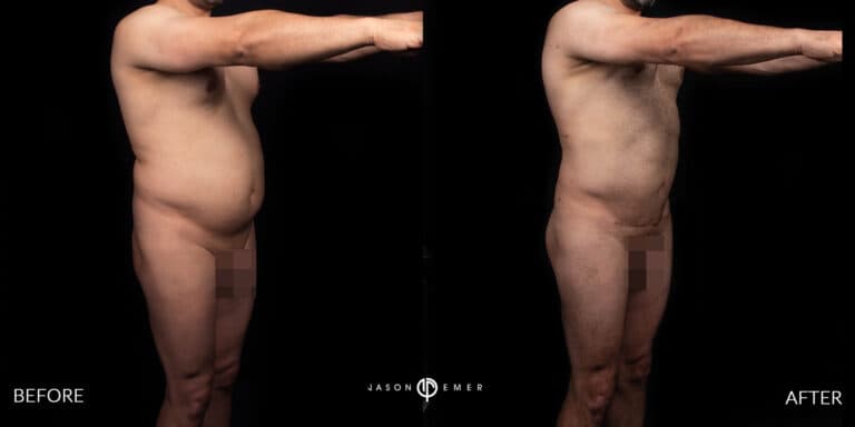 Full Body Male Gallery 03