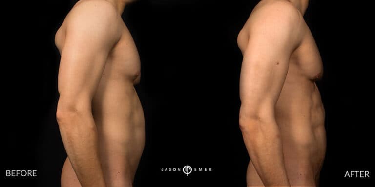 Abs Male Gallery 04