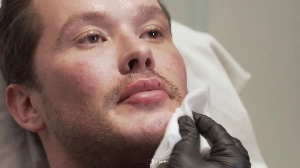 Facelift editorial composite — plastic surgery gallery