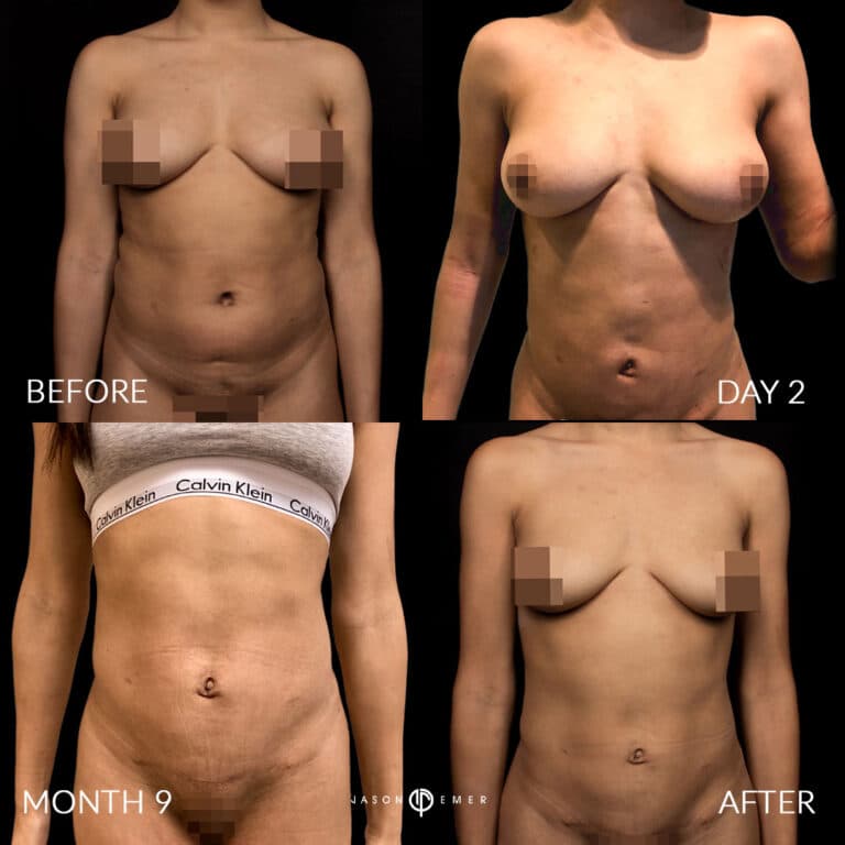 ABS FEMALE GALLERY 02
