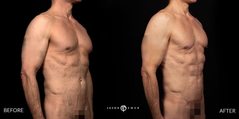 Abs Male Gallery 01