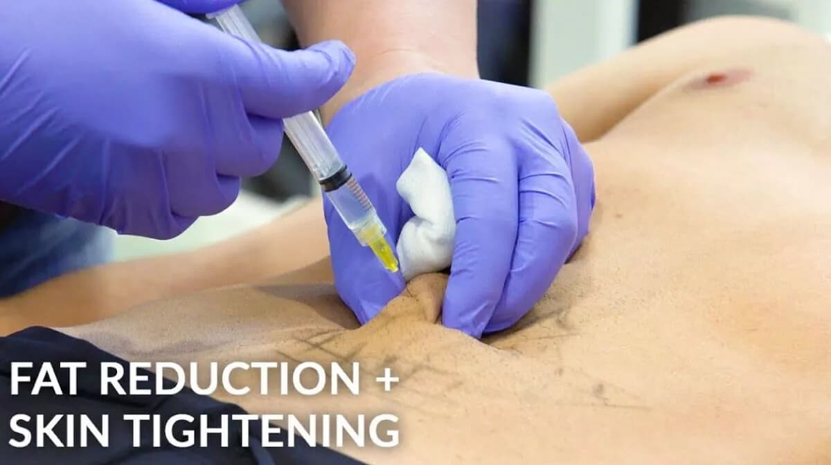 Body contouring editorial composite — non-surgical body contouring gallery