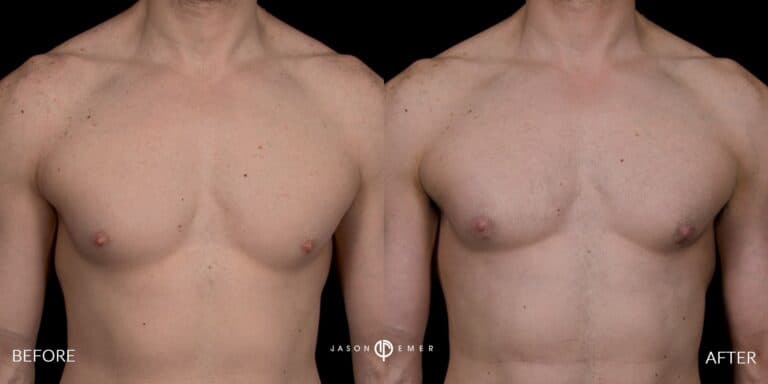 Full Body Male Gallery 06