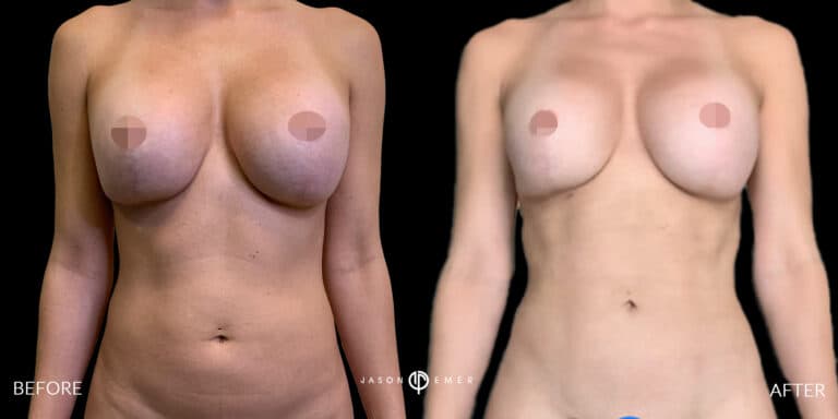 ABS FEMALE GALLERY 03