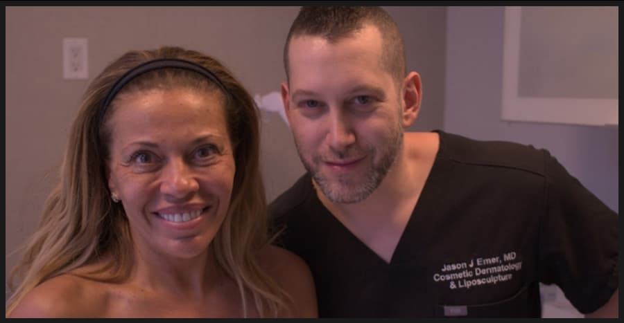Patient before and after