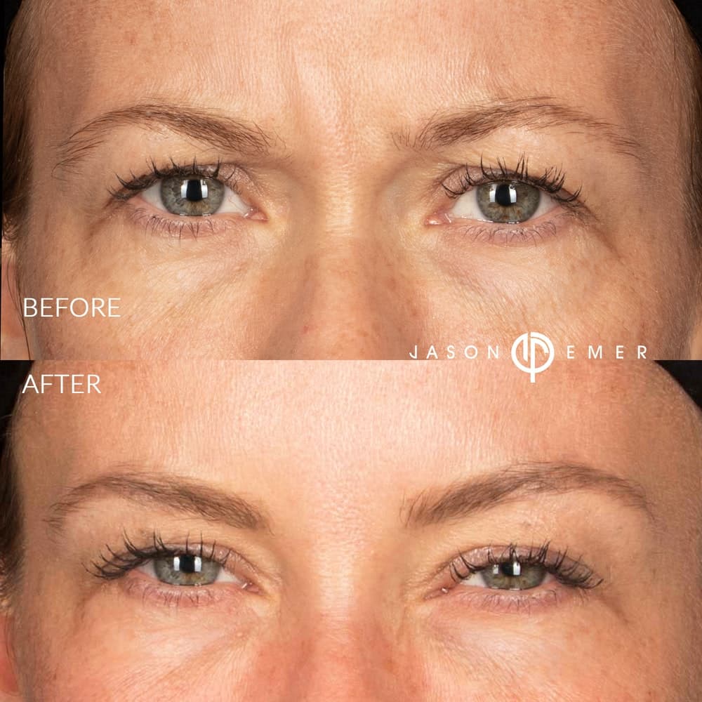 Patient before and after